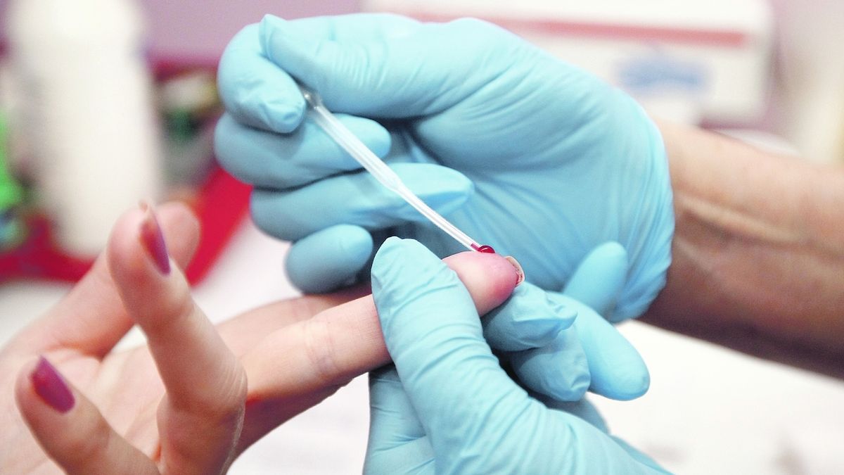 Kvůli nouzovému stavu ubylo testů na HIV, méně je i odhalených případů